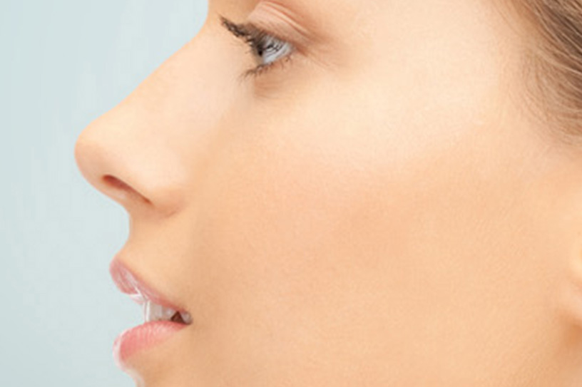 Nose Aesthetics (Rhinoplasty)